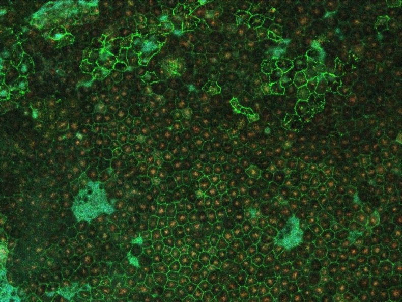 Fluorescent images of the retinal pigment epithelium