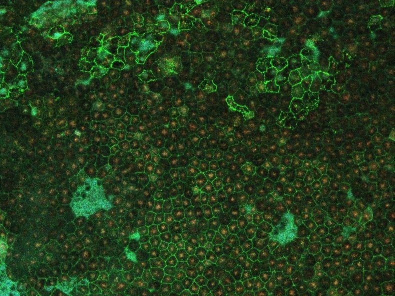 Fluorescent imaging of retinal pigment epithelium