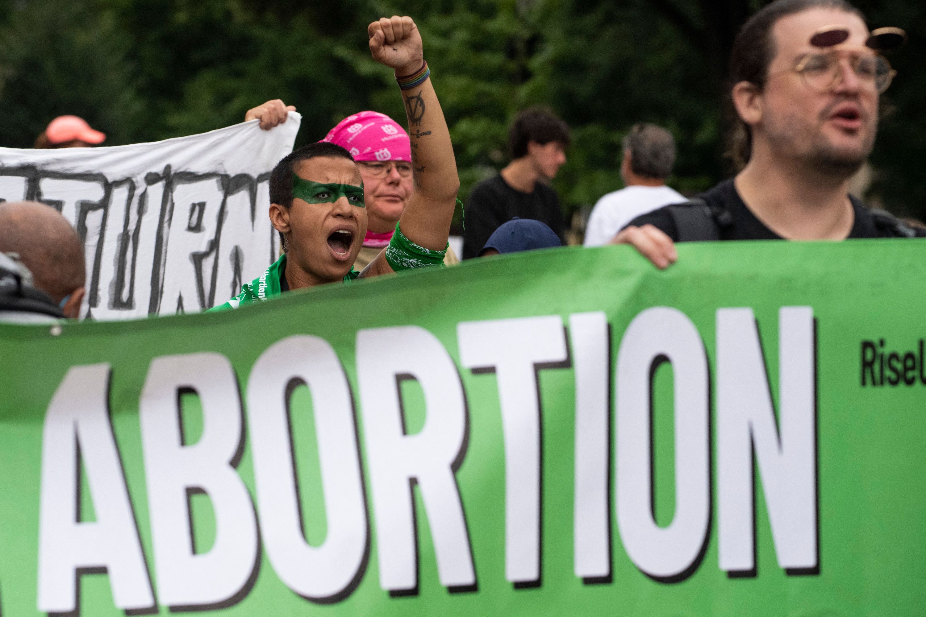 Treating Ectopic Pregnancies in A Pro-Life Culture | Opinion