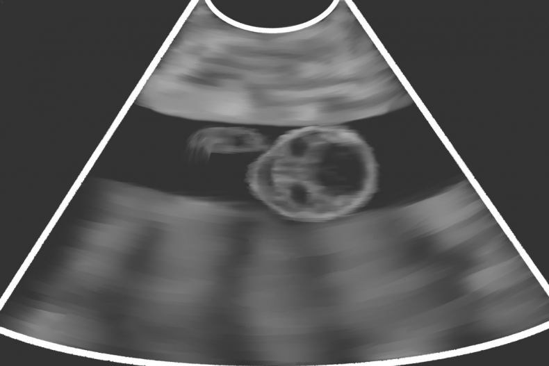 Mom admits she nearly choked at ultrasound 