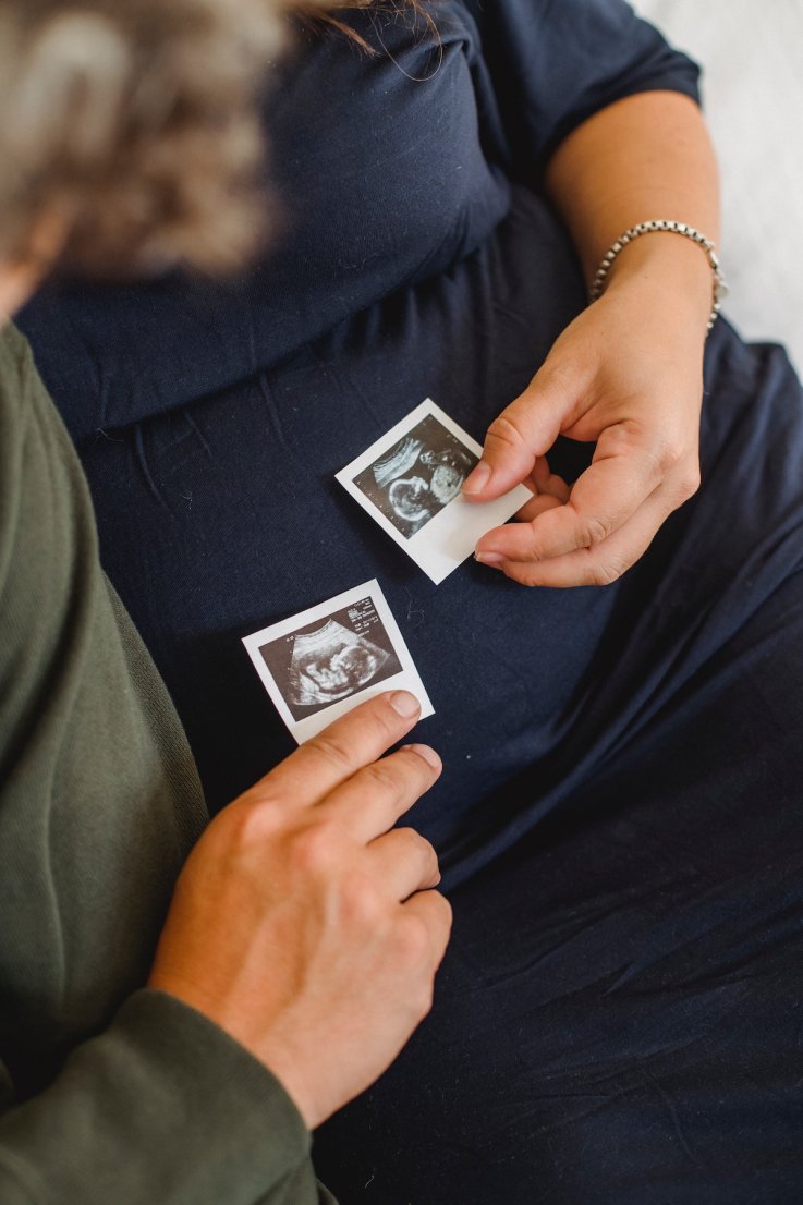 Couple with ultrasound of baby