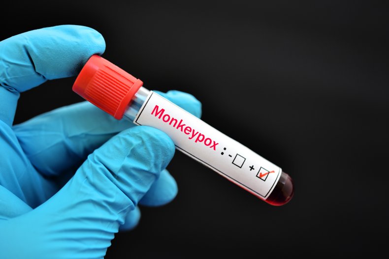 Monkeypox blood sample