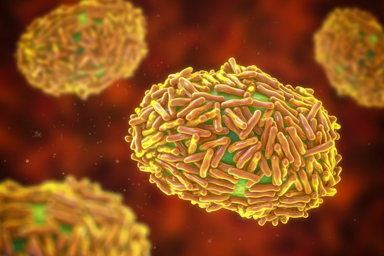 Monkeypox-virus kan weken overleven