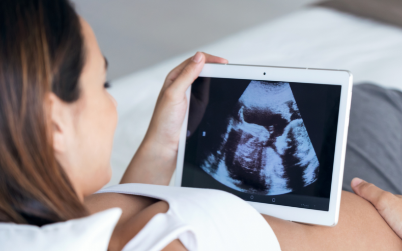 A pregnant woman looking at an ultrasound.