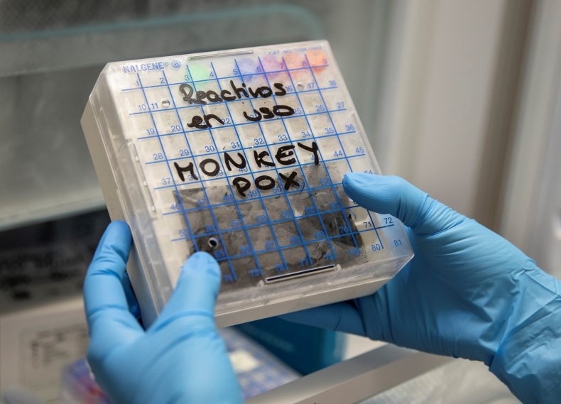 Suspected monkeypox samples