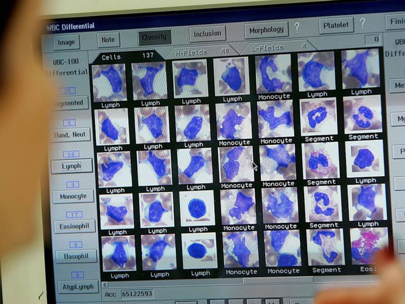 Computerized blood test results on screen