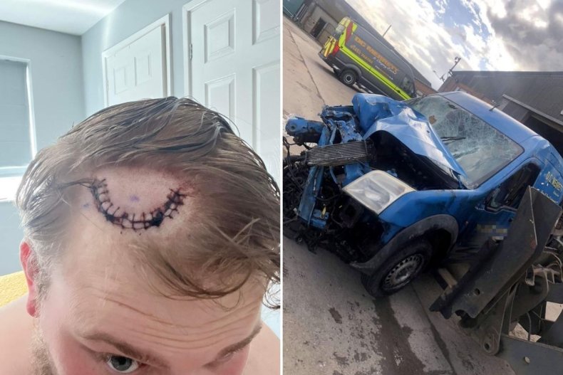 Thomas Crook car crash and hospital pics