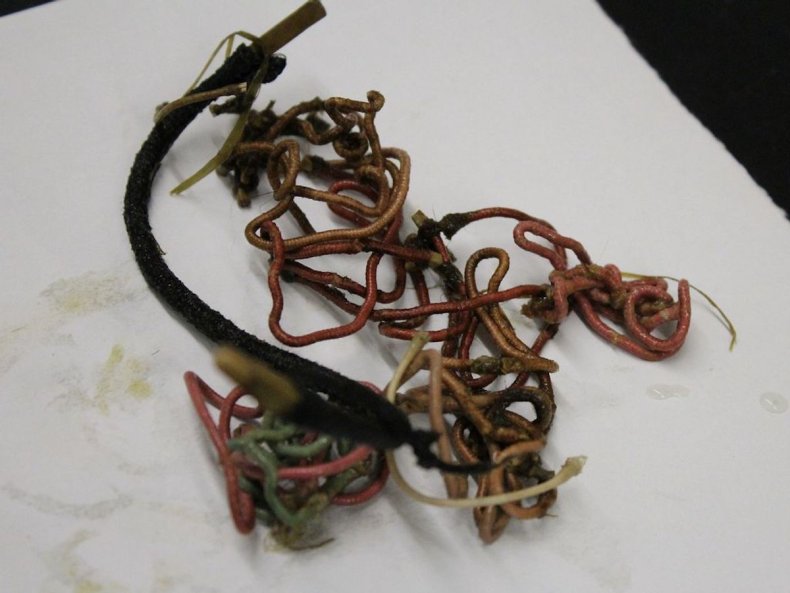 Hair bands swallowed by Hope