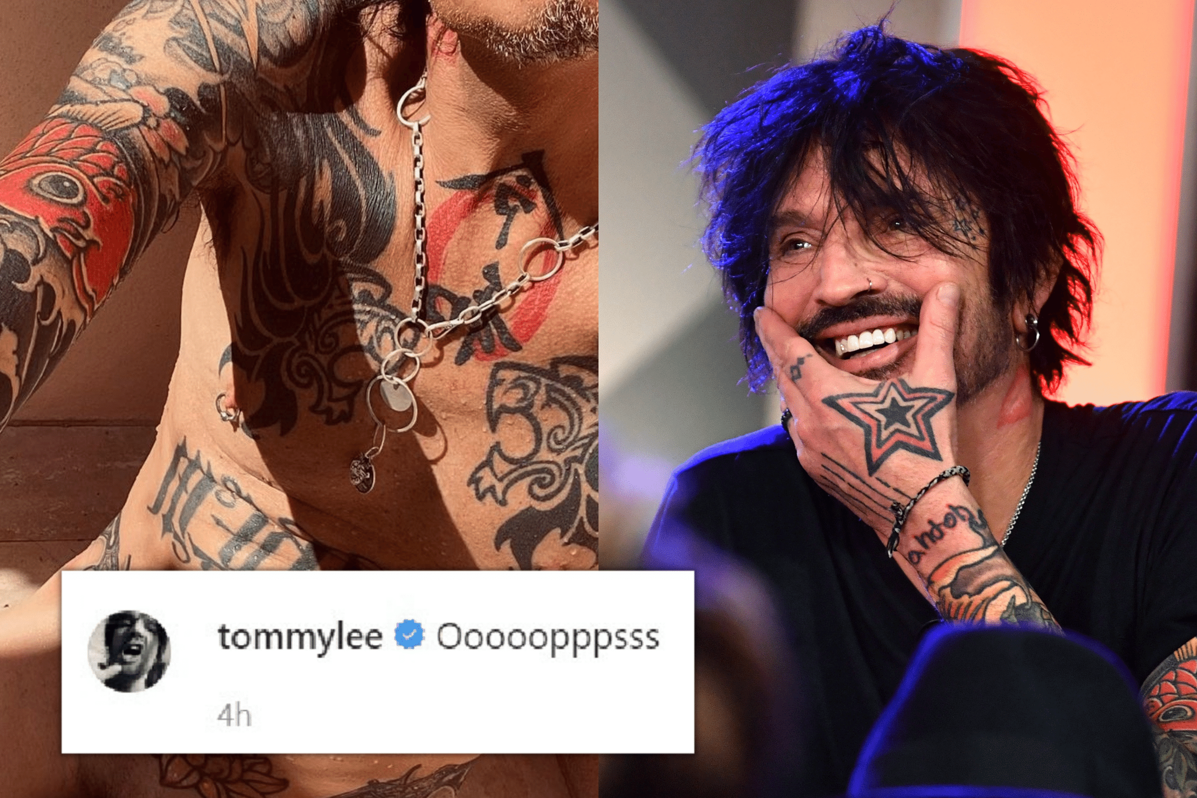 Tommy Lee posted a picture of his penis to Instagram