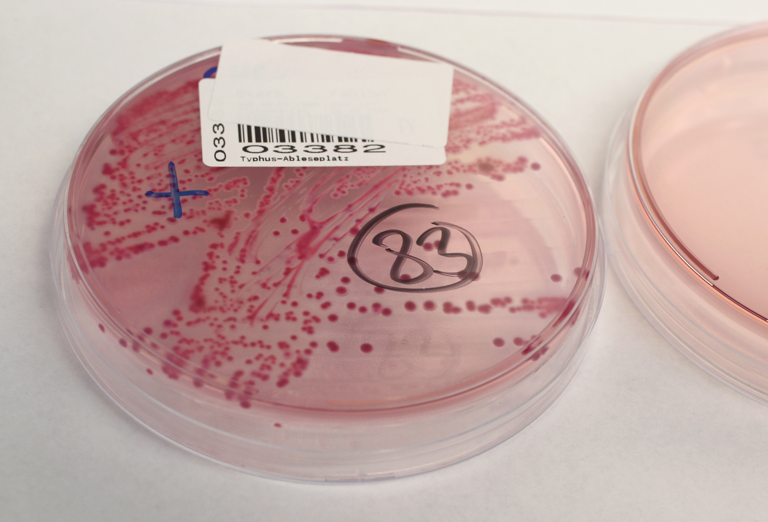 CDC Warns E Coli Outbreak Has Likely Infected More People Than   Cdc Warns Ecoli Outbreak 