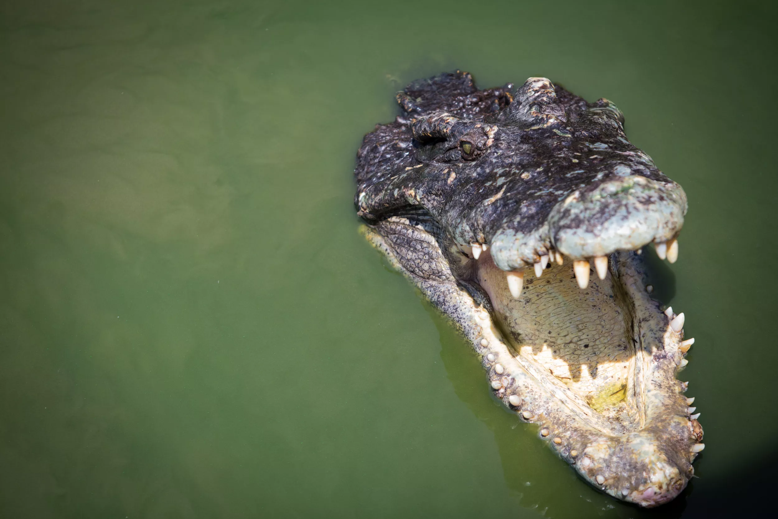 Surgeon Had to Untwist Man's Hand Muscle Six Times After Alligator Attack - Vimarsana News
