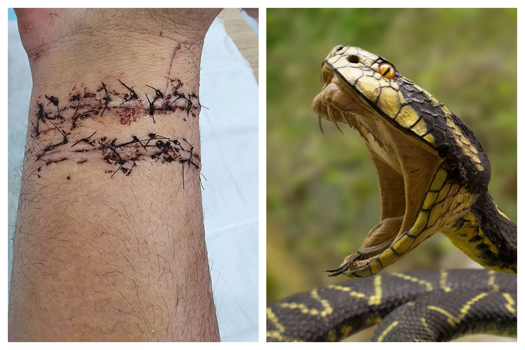 Python Severs Man's Artery with Bite 'Beyond Imagined Capabilities' - Vimarsana News