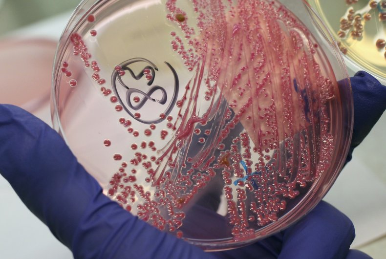 E. coli detected in Cape Coral Florida