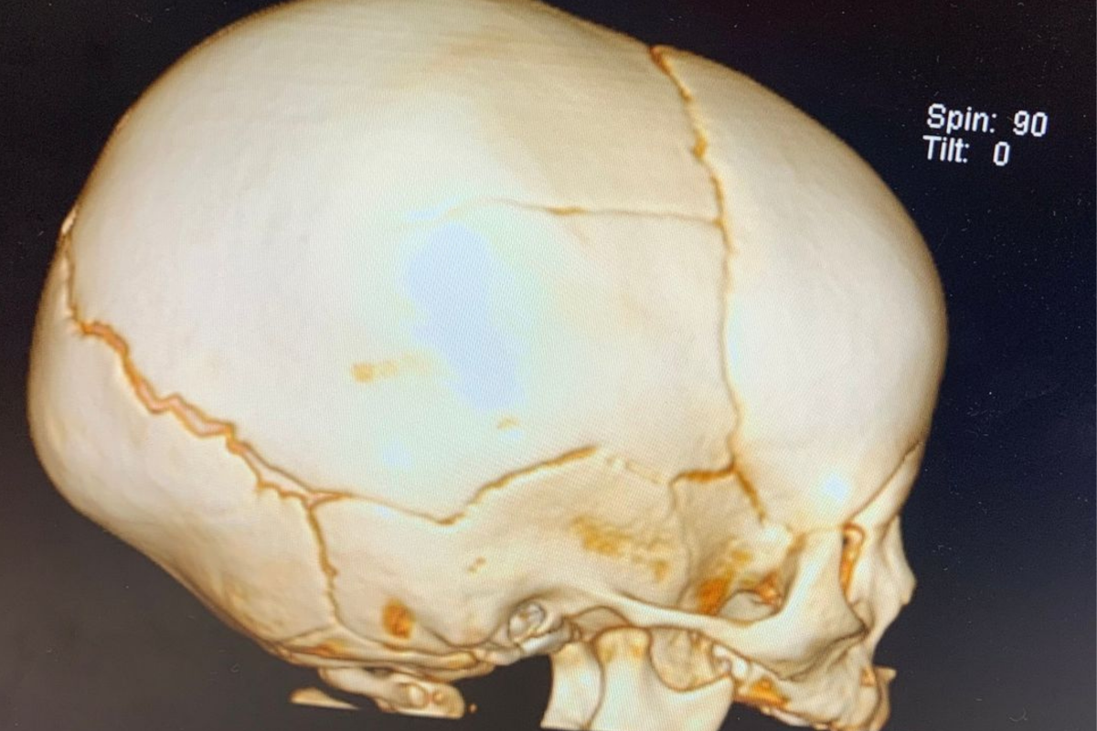 Scan of baby's skull. 