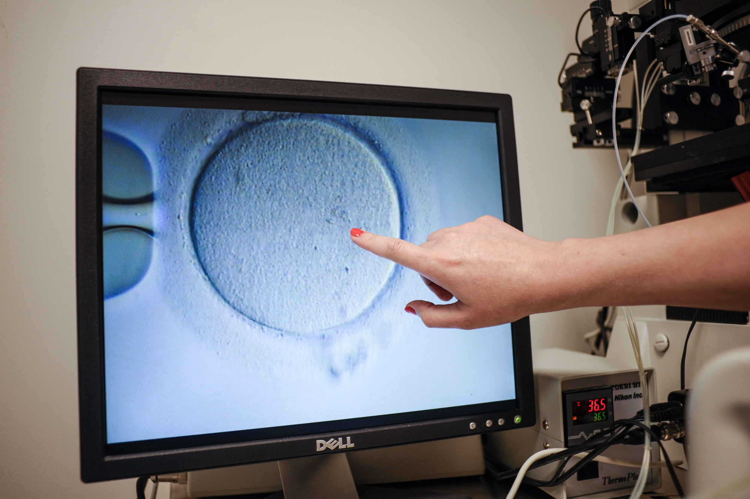 Frozen Embryos for IVF Raises Risk of High Blood Pressure Research