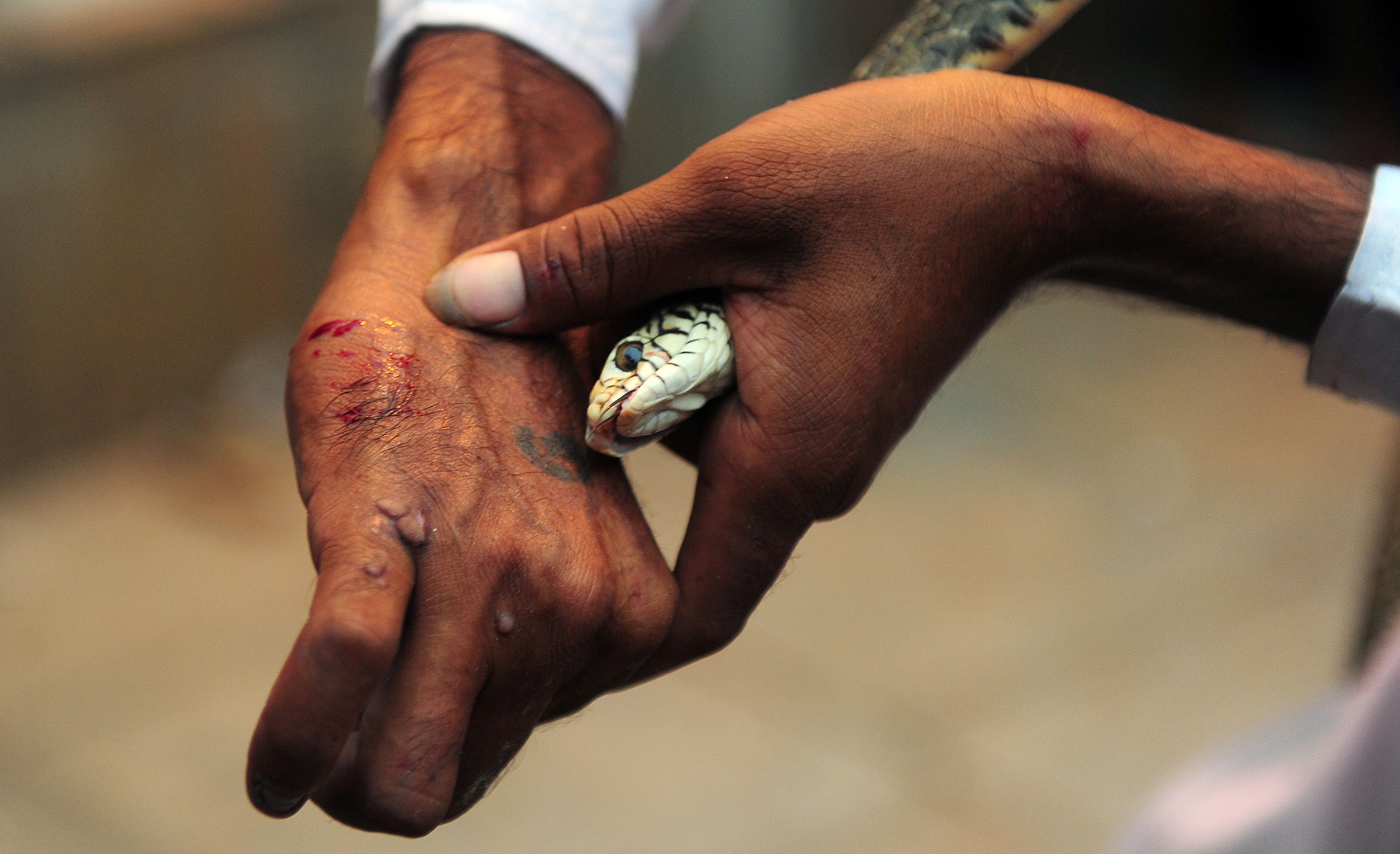 HOLD HOLD HOLD Thousands of people could die from herbal remedies snake bites India