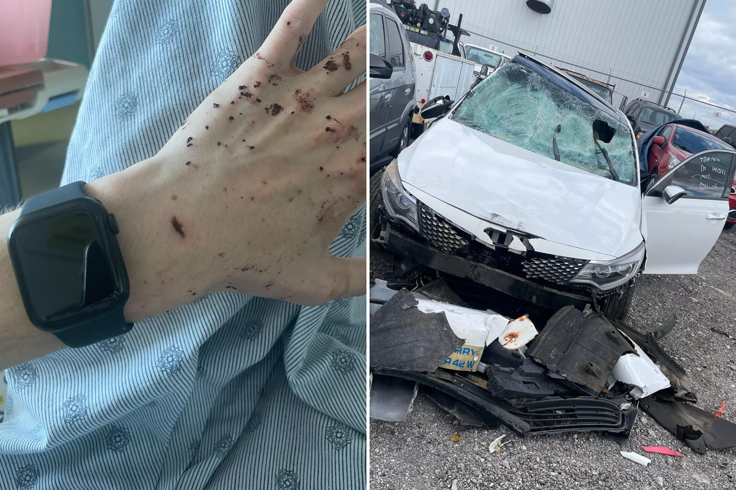 Man in 'Life or Death' 70mph Car Crash Credits Apple Watch for Saving Him - Vimarsana News