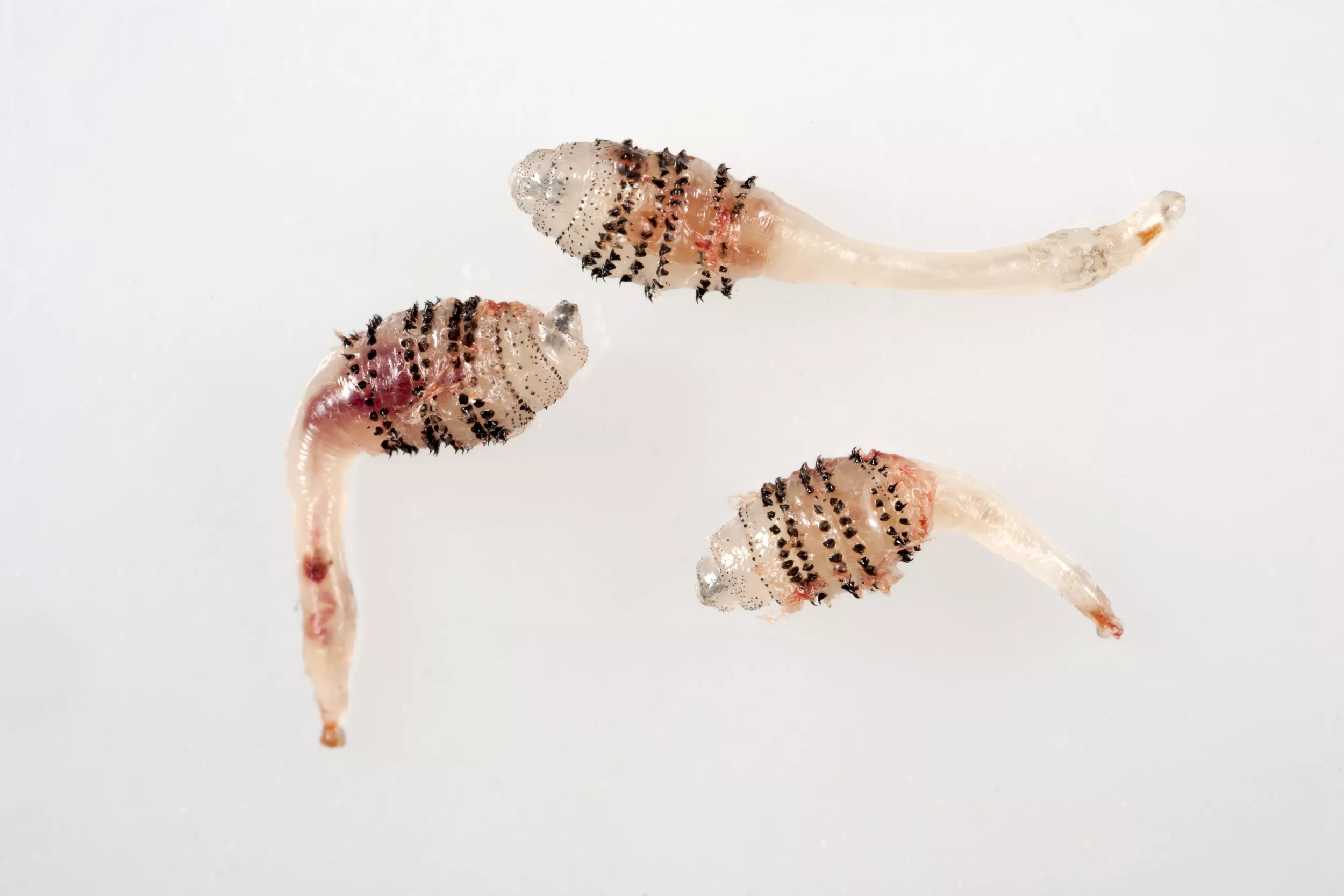 Woman Had White Maggots Covered in Black Dots Living in Arm for Months - Vimarsana News
