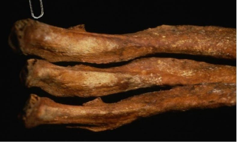 The ribs of JB55.