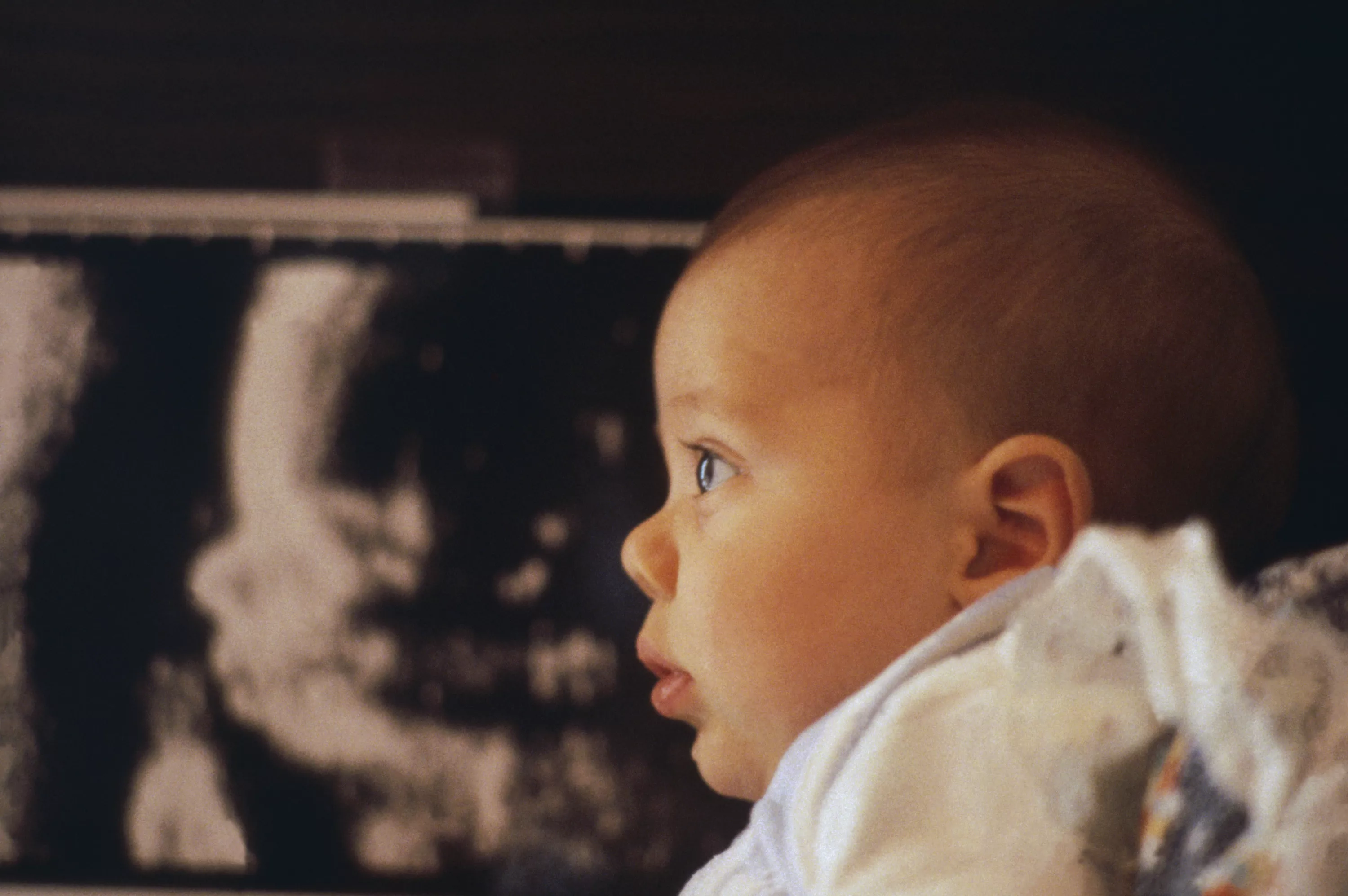 Many Doctors Think My Daughter Shouldn't Be Alive. They're Wrong - Vimarsana News