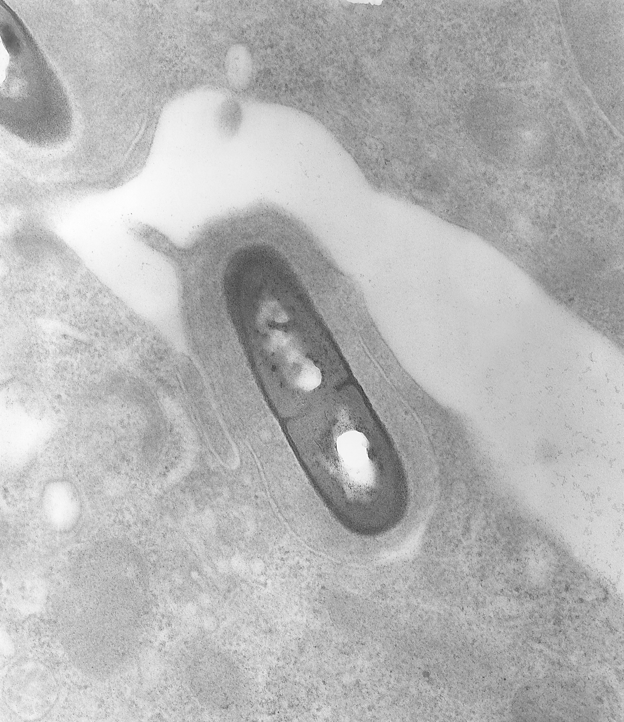 Can The Ex Fsai Chief Save Ballymaguire From The Listeria Outbreak? - axqkq45