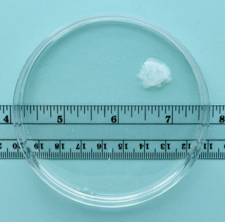 Pregnancy tissue at 6 weeks