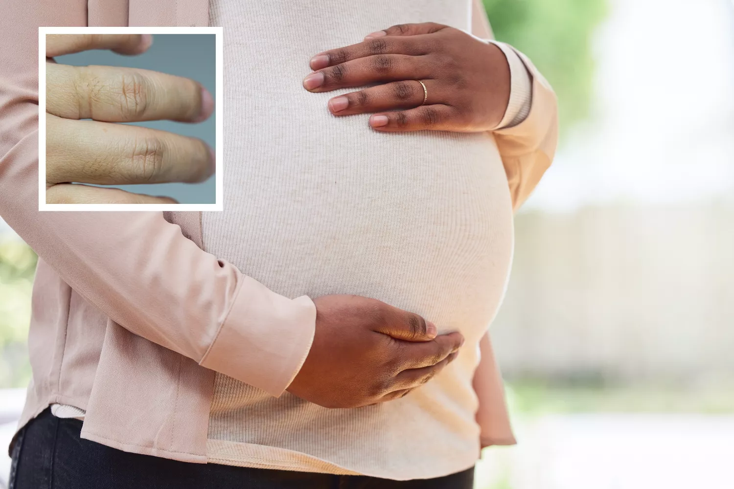 Watch Pregnant Woman Forced to Get Wedding Ring Cut Off After Eight Years - Vimarsana News