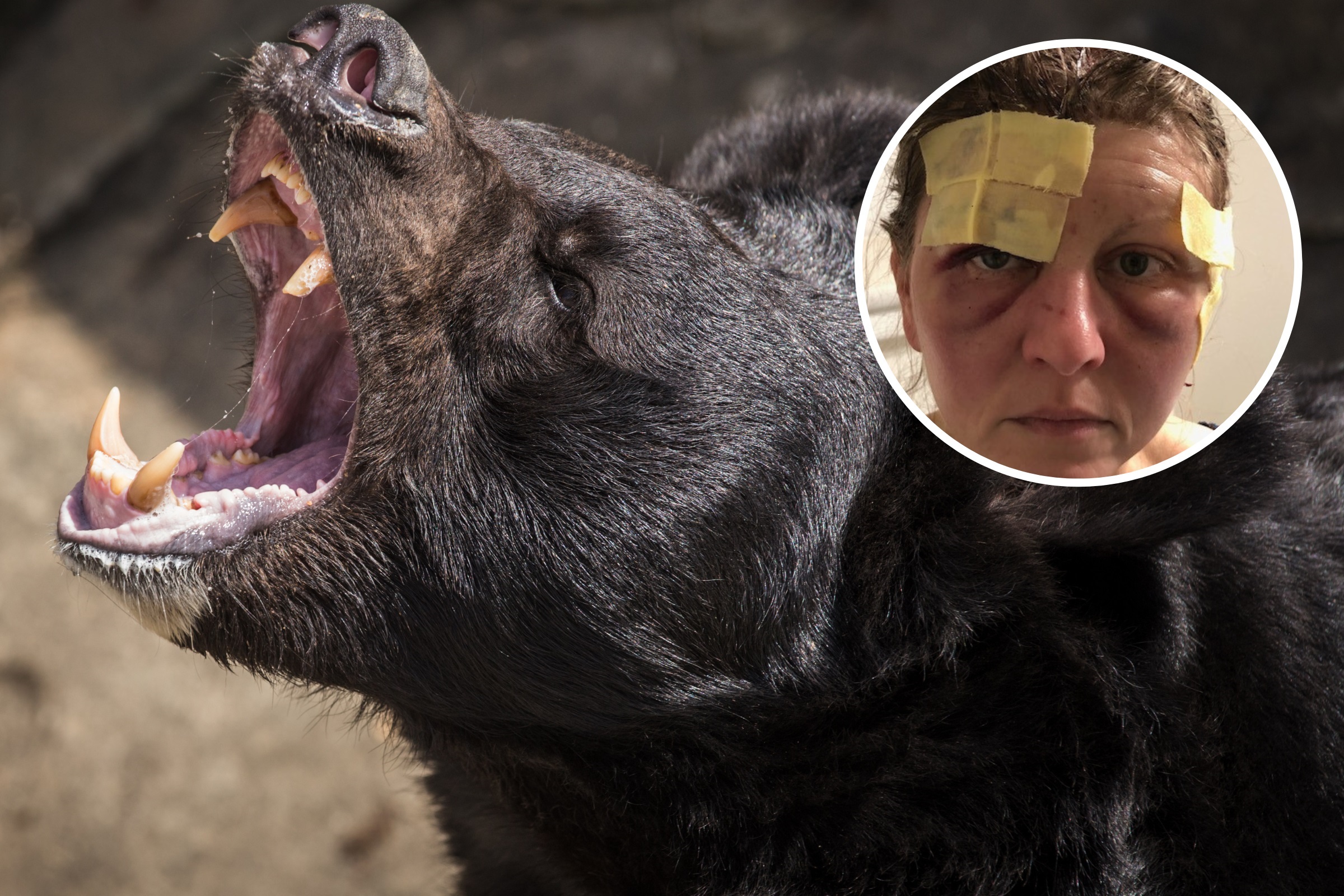 Mauled by a bear? Viral story in Russia is fake