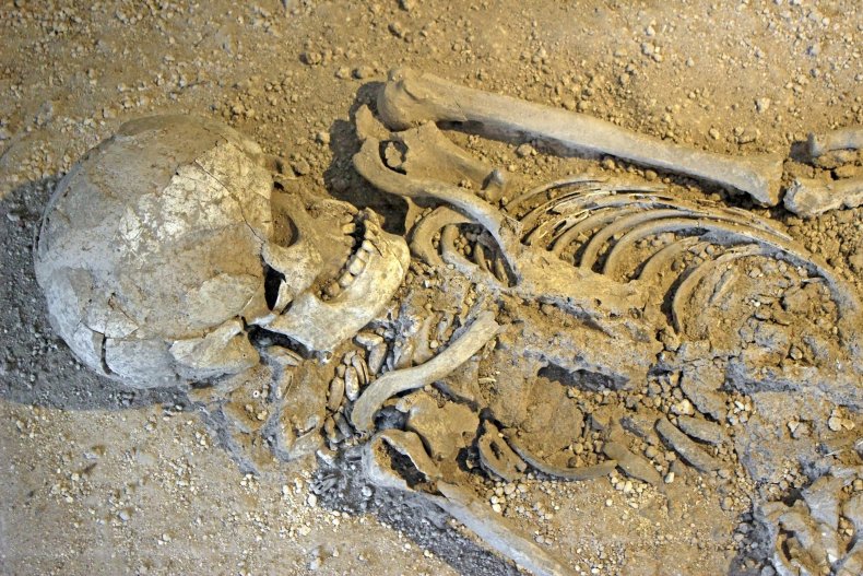bones