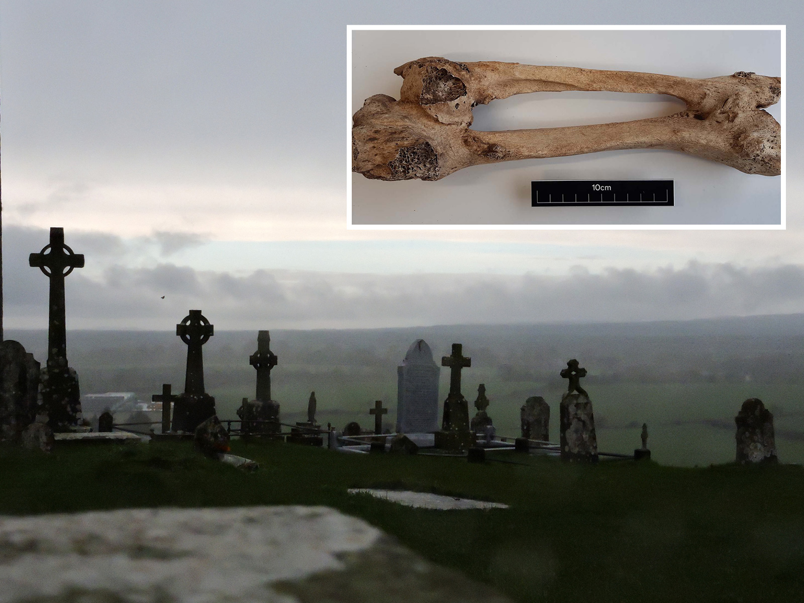 Long Lost Medieval Graveyard With Over 1,300 Bodies Reveals Mutation Mystery