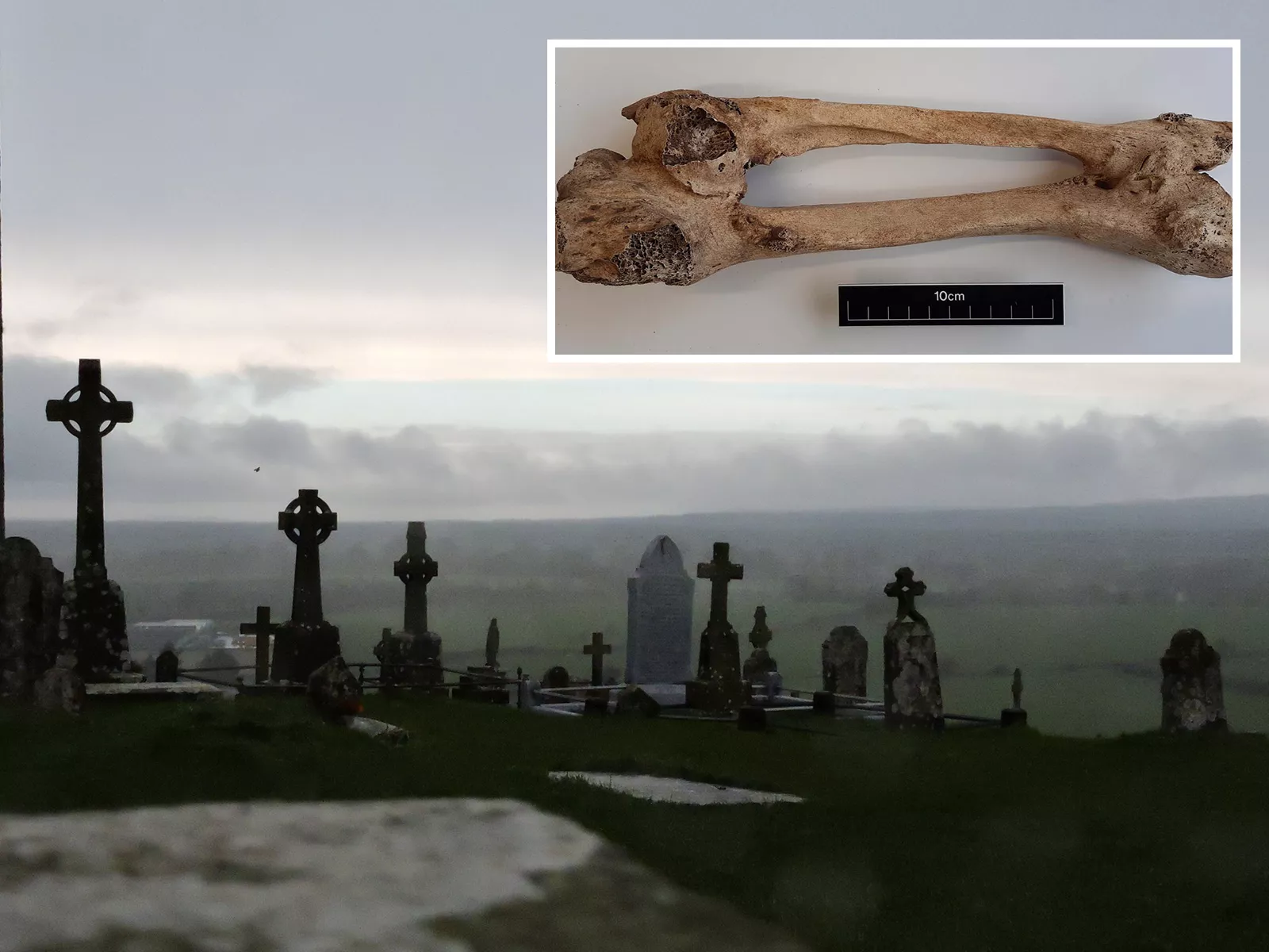 Lost Medieval Graveyard With Over 1,300 Bodies Reveals Mutation Mystery - Vimarsana News