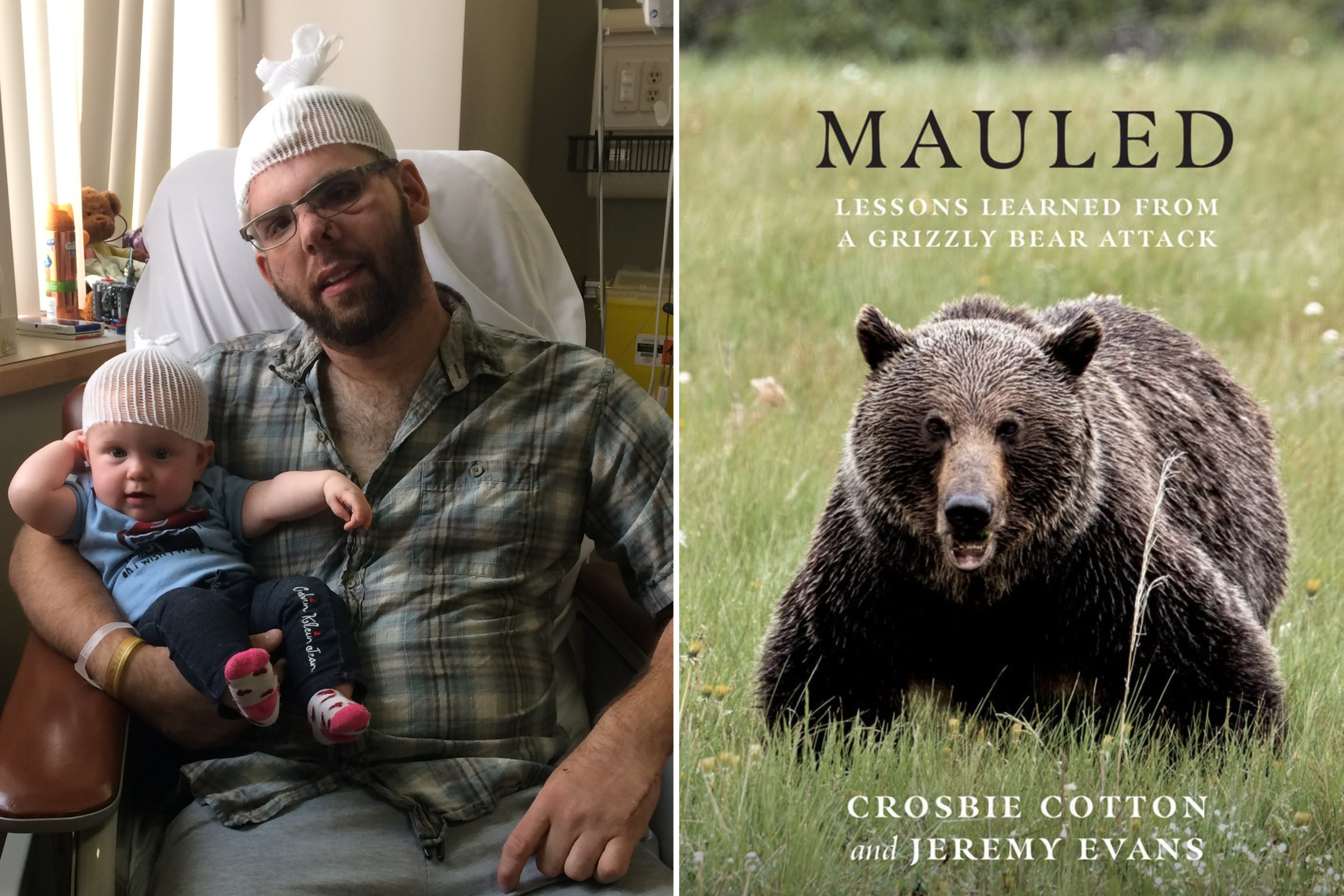 Man Who Escaped After Bear Crushed His Skull On How He Survived - Newsweek