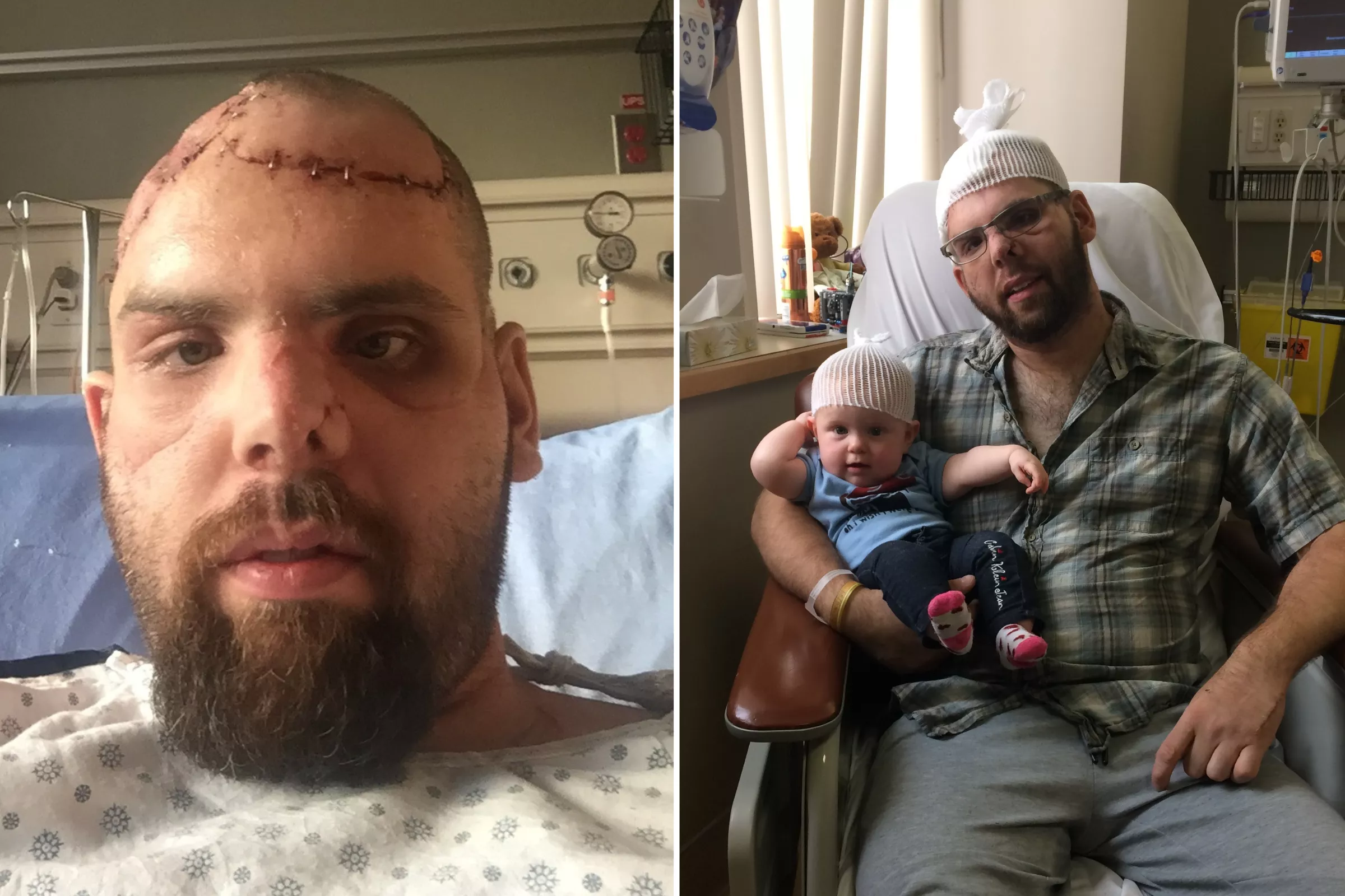 Man Relives Sickening 300-Pound Grizzly Bear Attack: 'Missing My Face' - Vimarsana News