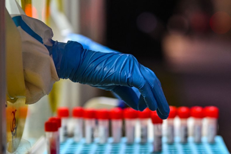 China Undercounts COVID-19 Deaths Amid Nationwide Outbreak