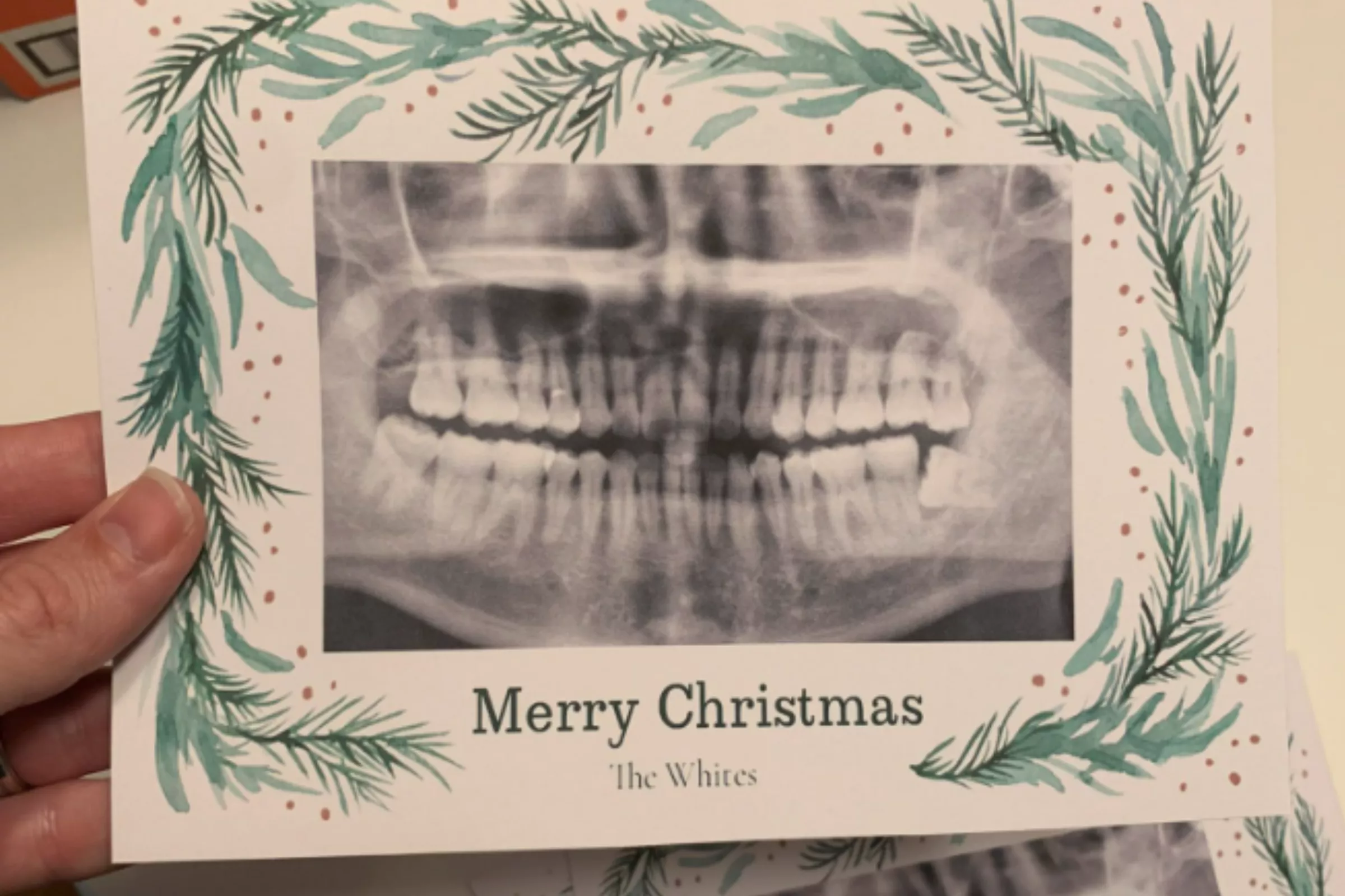 Man Stuck With 90 Christmas Cards of Neighbor's Teeth After Photo App Fail - Vimarsana News