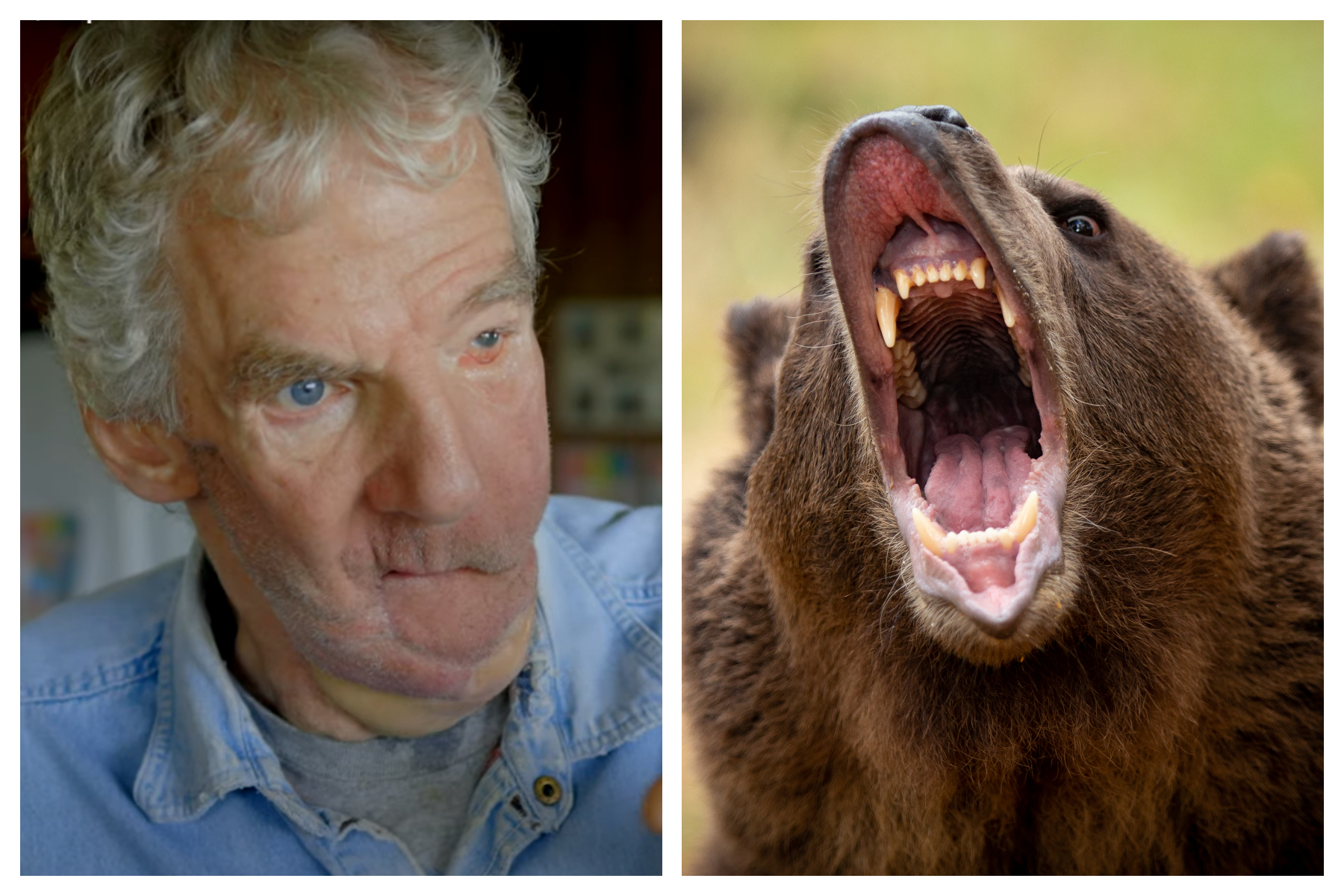 Man Who Had Face Torn Off By A Bear Had To Dig Debris From His Own   Wes Perkins Grizzly Bear 