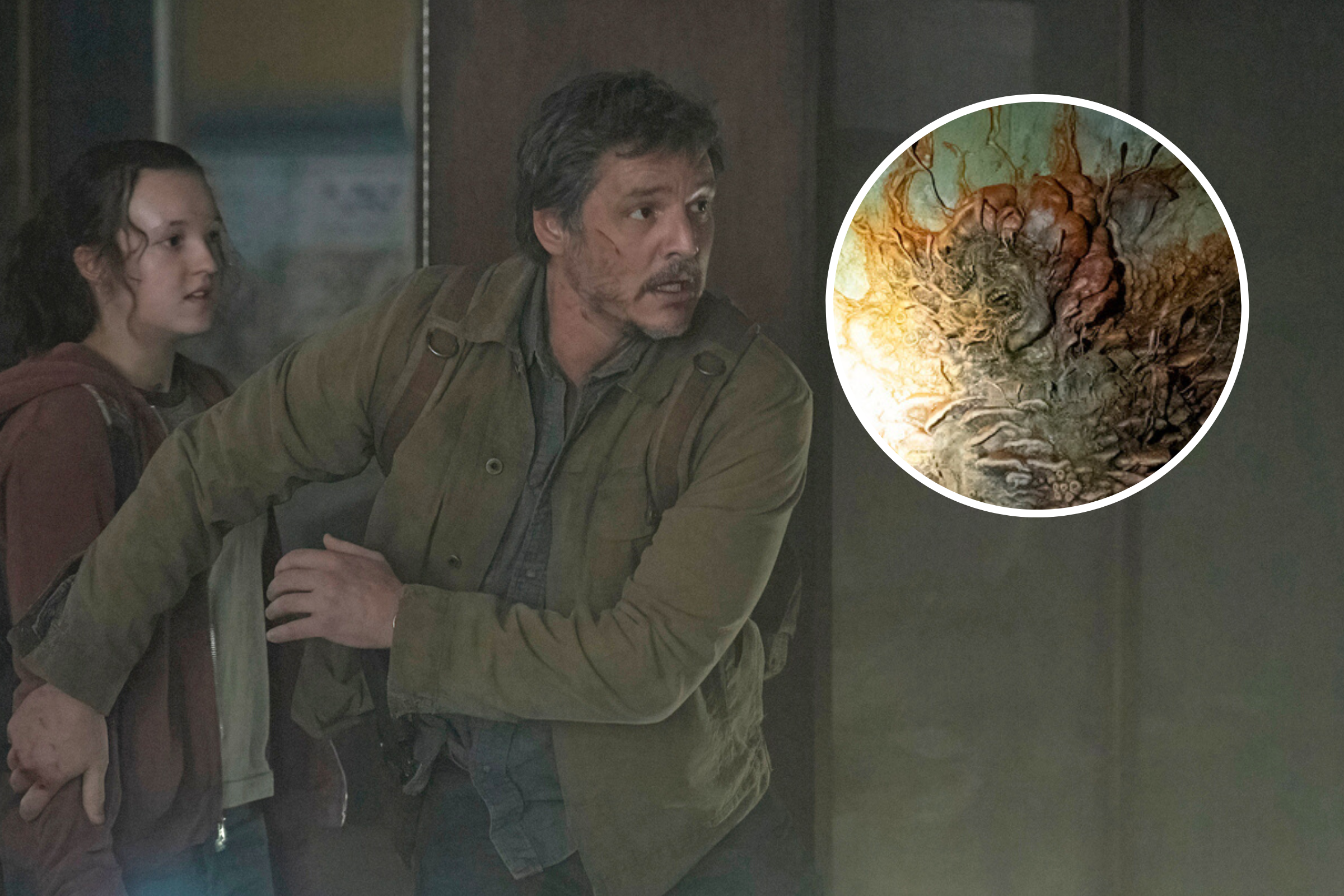 Joel's Condition in HBO's 'The Last of Us', Explained