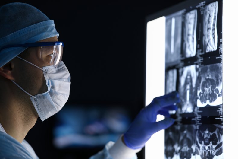 Doctor studying MRI scan