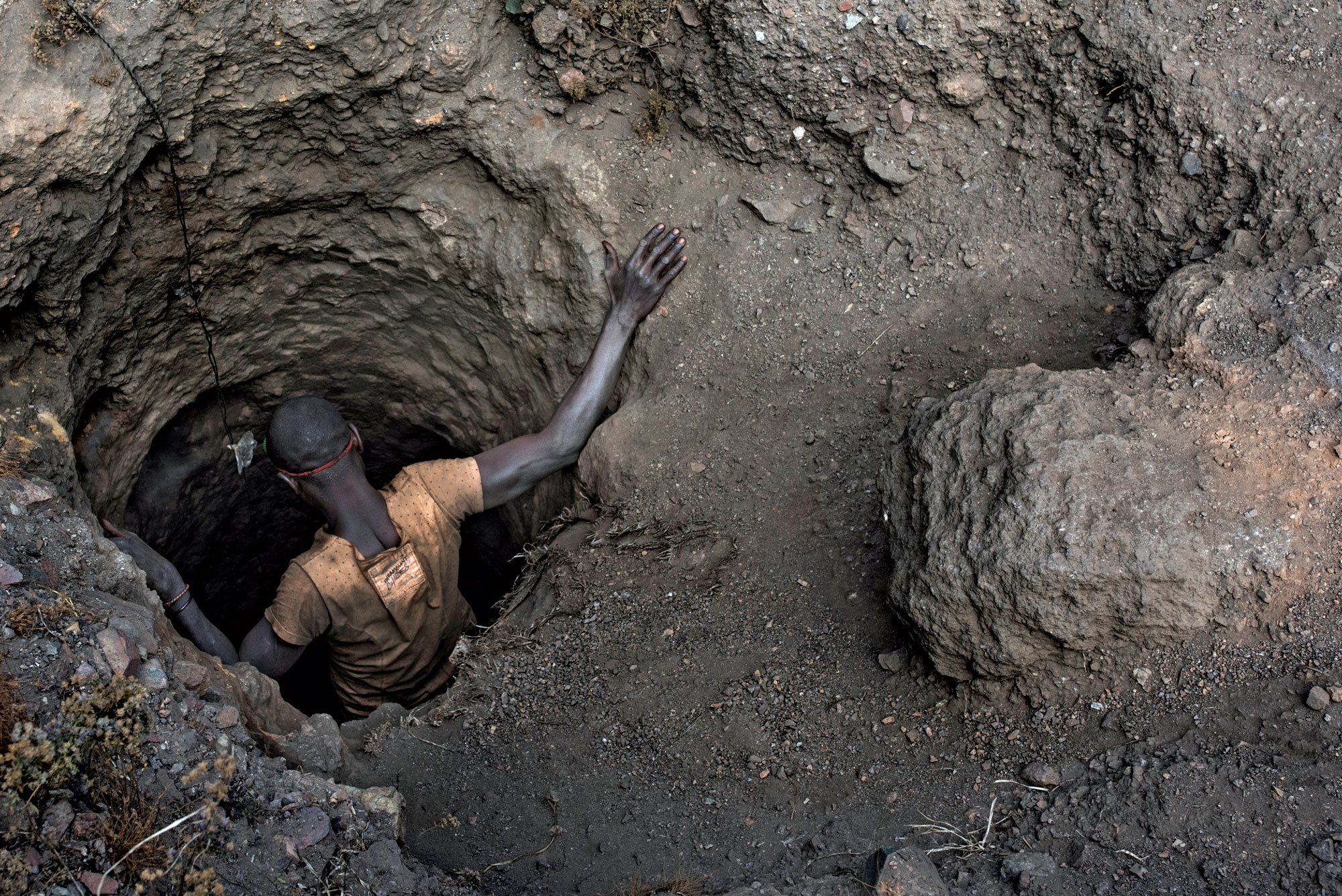 Cobalt Mining Health Problems