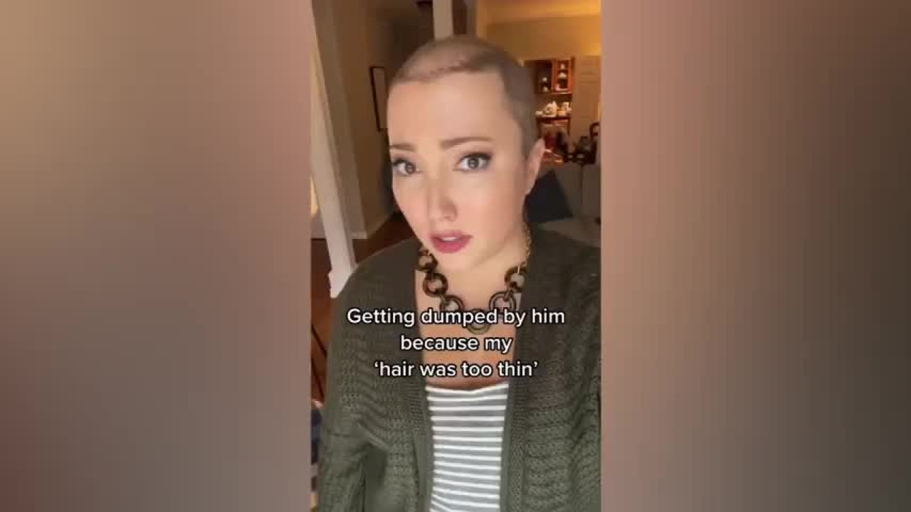 Woman Shares Heartbreak of Getting Dumped Because Her 'Hair Was Too Thin' Woman Shares Heartbreak of Getting Dumped Because Her 'Hair Was Too Thin'