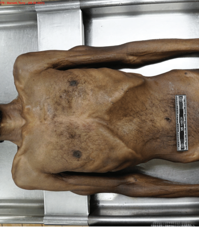 Autopsy Photo of Larry Eugene Price, Jr.