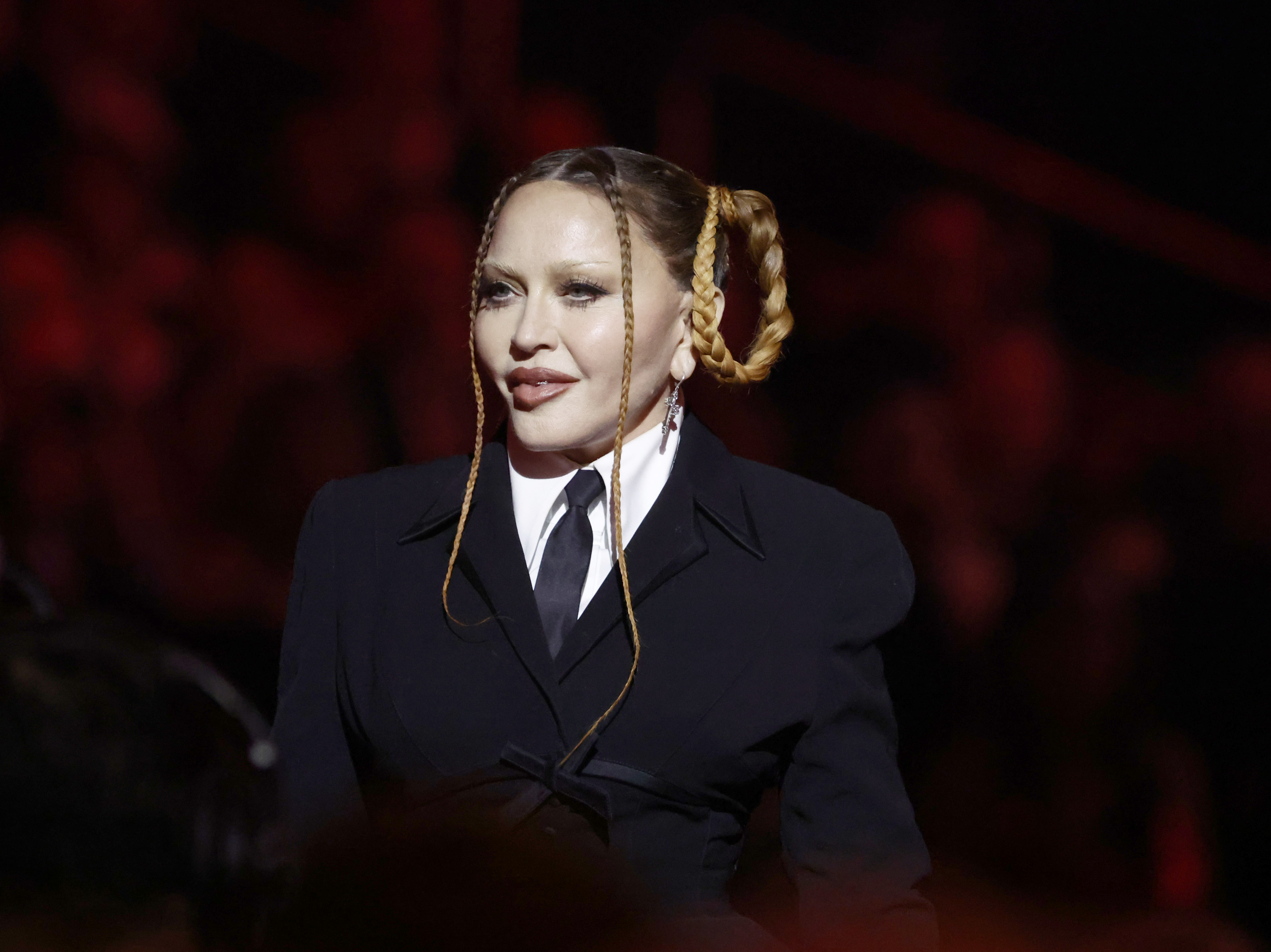 Madonna Shows Off Cute Face After Grammys Backlash Swelling Went Down