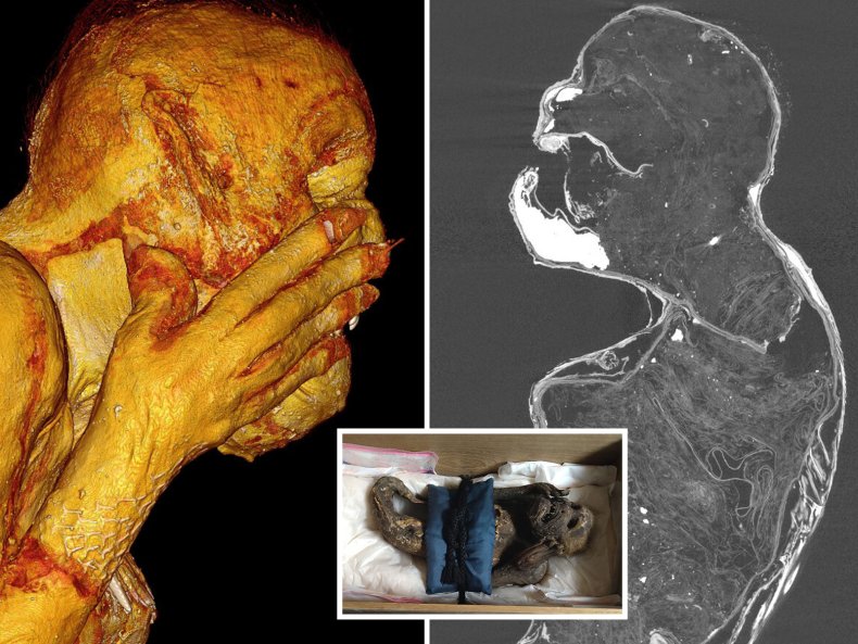 Mummy Mermaid Scan
