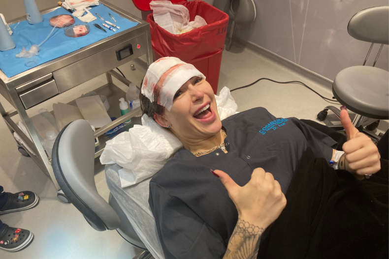 Tracy Kiss tersenyum pasca operasi transplantasi rambut