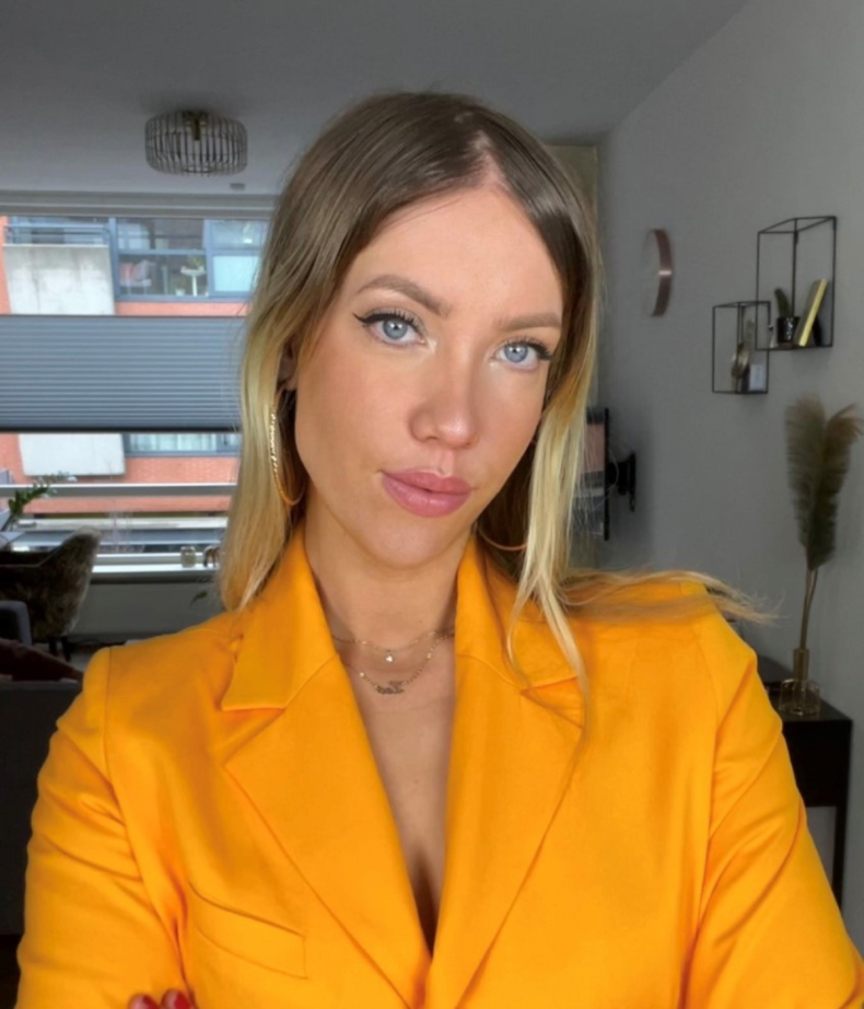 Sonja van den berg pasca operasi transplantasi rambut