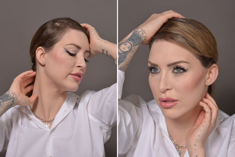 Tracy Kiss, Post-Hair Transplant Photoshoot