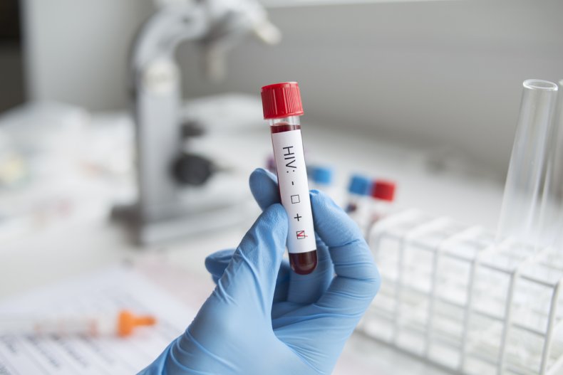 HIV stock image