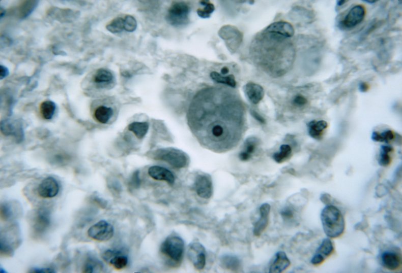 N. fowleri is a deadly brain-eating amoeba