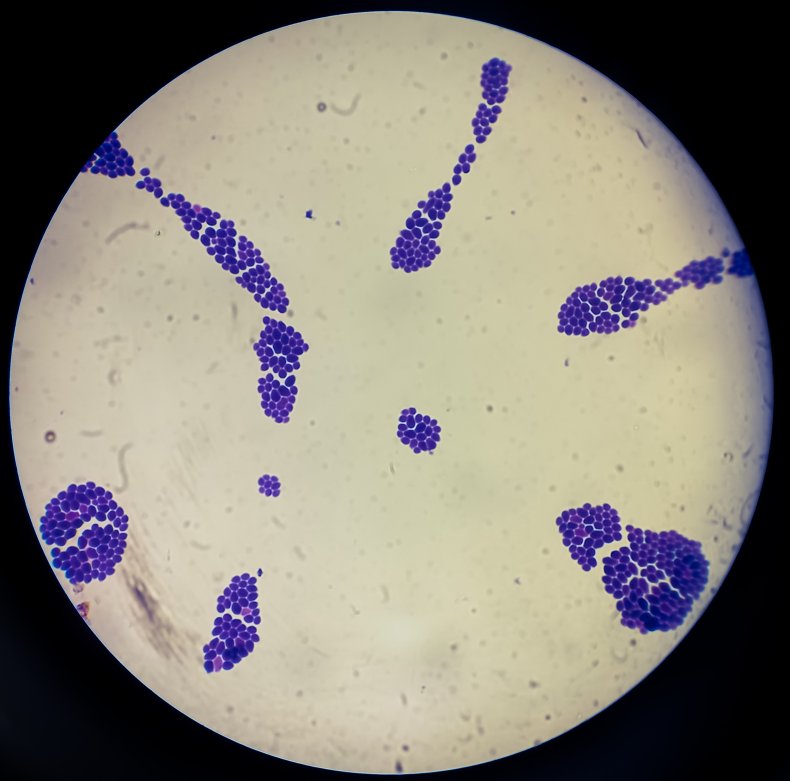 Candida auris microscopy