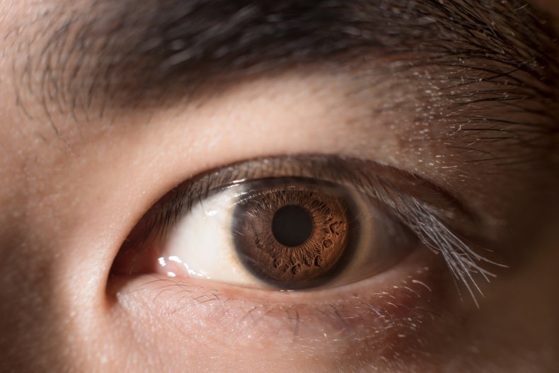 Close-up photo of a man's eye